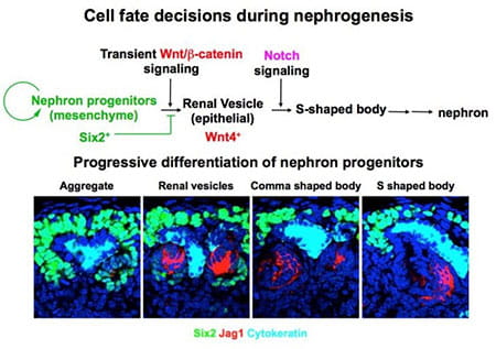 Nephron progenitors express Six2, a transcription factor that is required for progenitor self-renewal. Differentiation of nephron progenitors is induced by Wnt/b-catenin and Notch signals. We have shown that Six2 represses differentiation of nephron progenitors by preventing Wnt/b-catenin signaling from activating key differentiation genes, such as Fgf8 and Wnt4. Once expression of Six2 is downregulated, nephron progenitors undergo differentiation by responding to Wnt/b-catenin and Notch signals. Nephron progenitors express Six2, a transcription factor that is required for progenitor self-renewal. Differentiation of nephron progenitors is induced by Wnt/b-catenin and Notch signals. We have shown that Six2 represses differentiation of nephron progenitors by preventing Wnt/b-catenin signaling from activating key differentiation genes, such as Fgf8 and Wnt4. Once expression of Six2 is downregulated, nephron progenitors undergo differentiation by responding to Wnt/b-catenin and Notch signals.